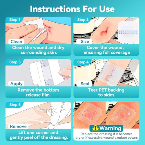 Dimora Hydrogel Burn Dressing with Border 4" x 4" (2.5" x 2.5" Pad) – Sterile, Waterproof Burn & Wound Dressing with Instant Cooling Relief for Minor Burns, Cuts & Abrasions (10 Count) - size: 4" x 4" (2.5" x 2.5" Pad)-10 Count
