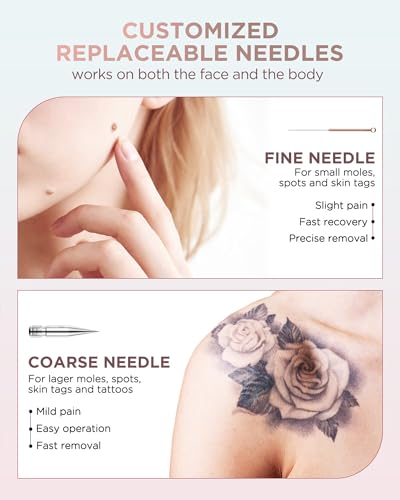 OPHERA Skin Tag Remover Pen with Remover Kits for Moles and Warts, Home Use