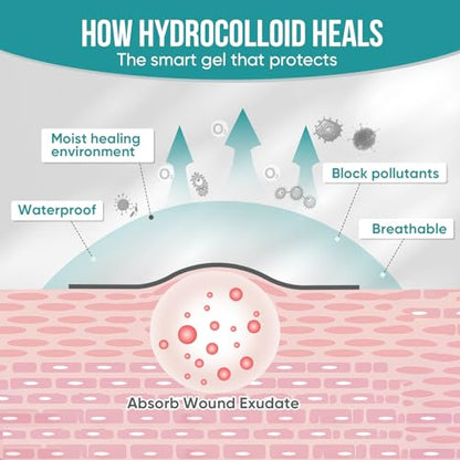Hydrocolloid Roll for Wound Care, Hydrocolloid Patch Bandages (2in x 12ft) - size: 2in x 12ft