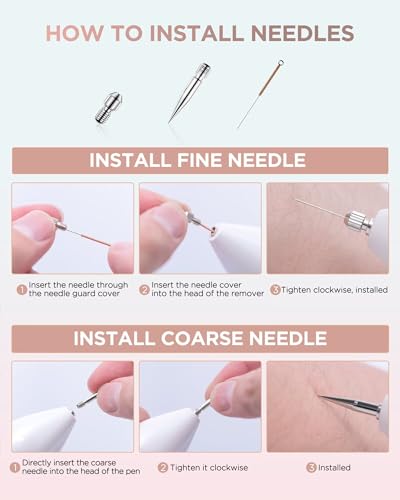 OPHERA Skin Tag Remover Pen with Remover Kits for Moles and Warts, Home Use