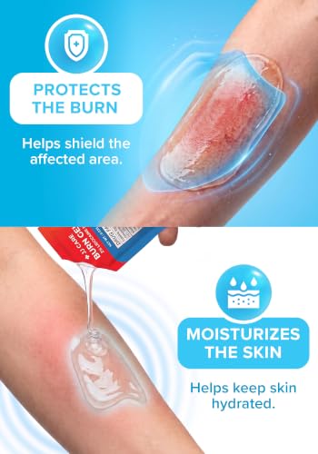 Burn Gel Packet | 160-Pack | with Lidocaine & Aloe Vera | FSA&HSA Eligible