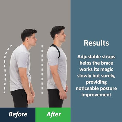 ComfyBrace Posture Corrector for Men and Women, Back Brace Straightener