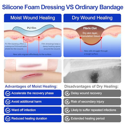 Niceful Silicone Foam Dressing 4"x4" 10 PCS Waterproof Bandages for Wound - size: 4"x4"(10 PCS)