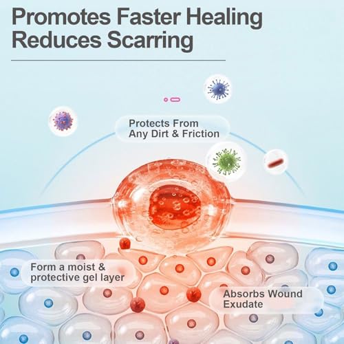 2IN*16.5FT Hydrocolloid Roll for Blister/Wound Care, Less Scar/Painless Removal, Hydrocolloid Bandages for Fast Healing, Medical-Grade, Customizable Dressing, Ultra Absorbent/Waterproof, First Aid Kit - size: 16.5FT