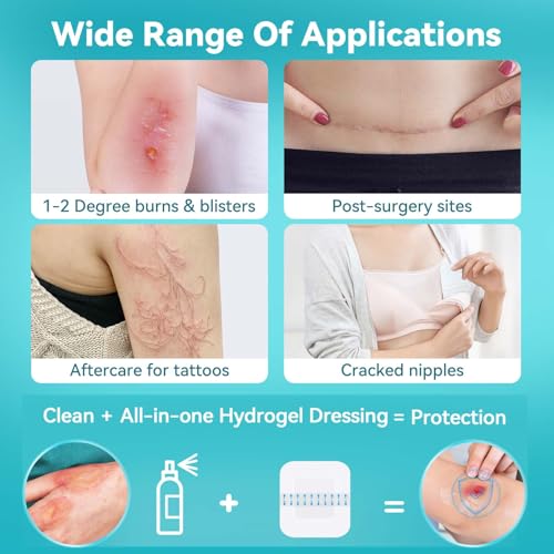 Dimora Hydrogel Burn Pads with Border 6" x 6" (4" x 4" Pad) – Sterile Burn & Wound Dressing with Instant Cooling Relief for Minor Burns, Cuts & Abrasions, Soothing Moist Waterproof Bandages (5 Count) - size: 6" x 6" (4" x 4" Pad)-5 Count