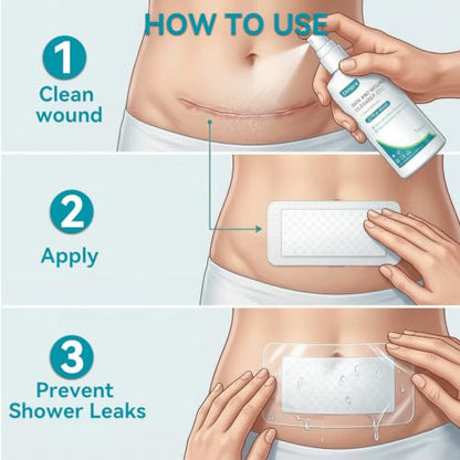 Dimora Silver Silicone Foam Dressing 4"x6" Ag Wound Care - size: 4"x6" Ag(10 PCS)